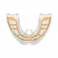 Myobrace para Brackets B2 Accesorio Intraoral Ortodoncia, Transparente, Grande 1 unidad Myofunctional